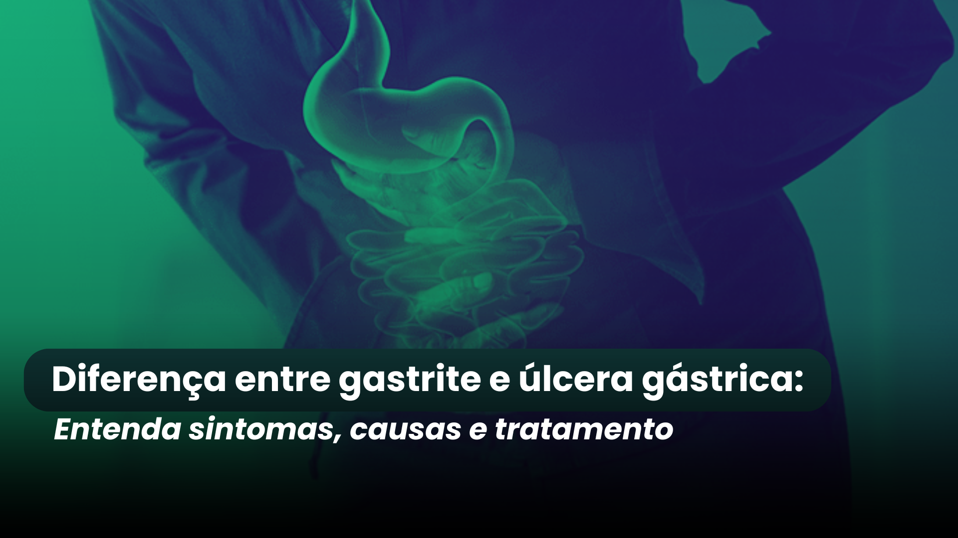 Diferença entre gastrite e úlcera gástrica